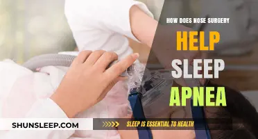 Nose Surgery for Sleep Apnea: Breathing Easier, Sleeping Better