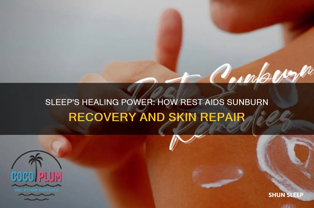 how does sleep help sunburn