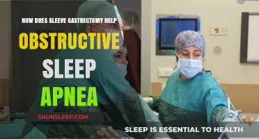 Sleeve Gastrectomy: Effective Treatment for Obstructive Sleep Apnea Relief