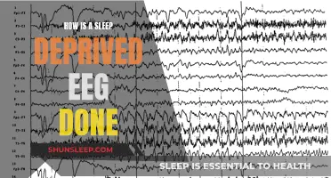 Sleep Deprived EEG: A Guide to the Procedure