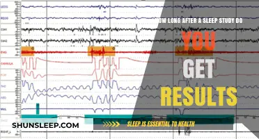 Sleep Study Results Timeline: What to Expect After Your Test