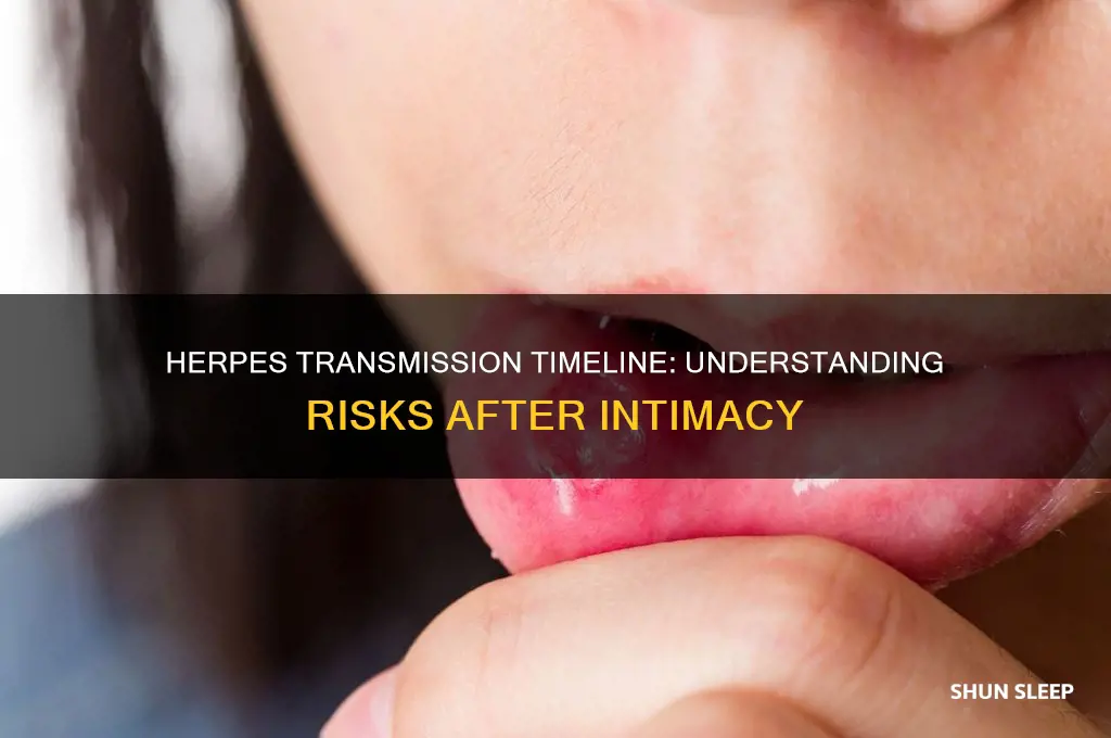 how long after sleeping with someone can you get herpes
