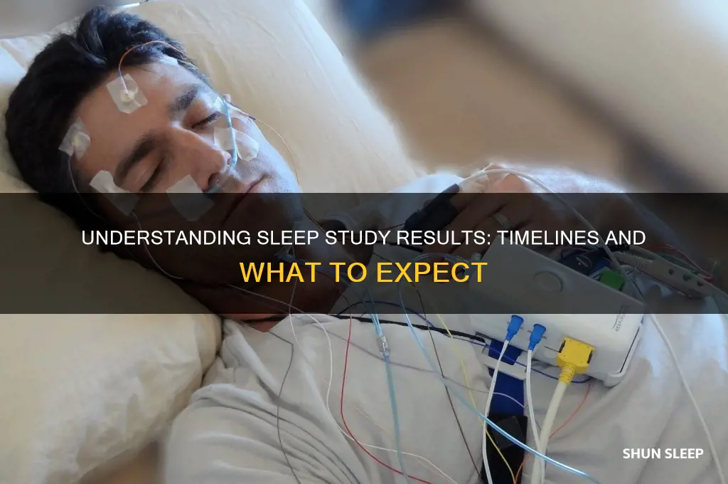 how long to get sleep study results