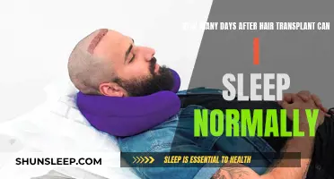 Hair Transplant Recovery: Sleeping Normally After Surgery