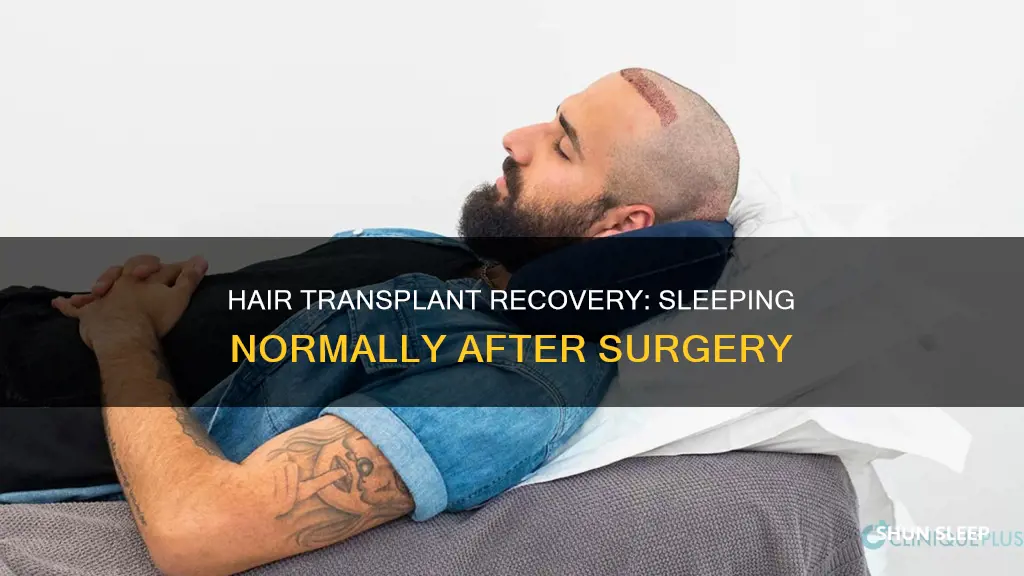 how many days after hair transplant can i sleep normally