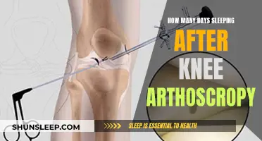 Knee Arthroscopy: Recovery and Sleep Guide