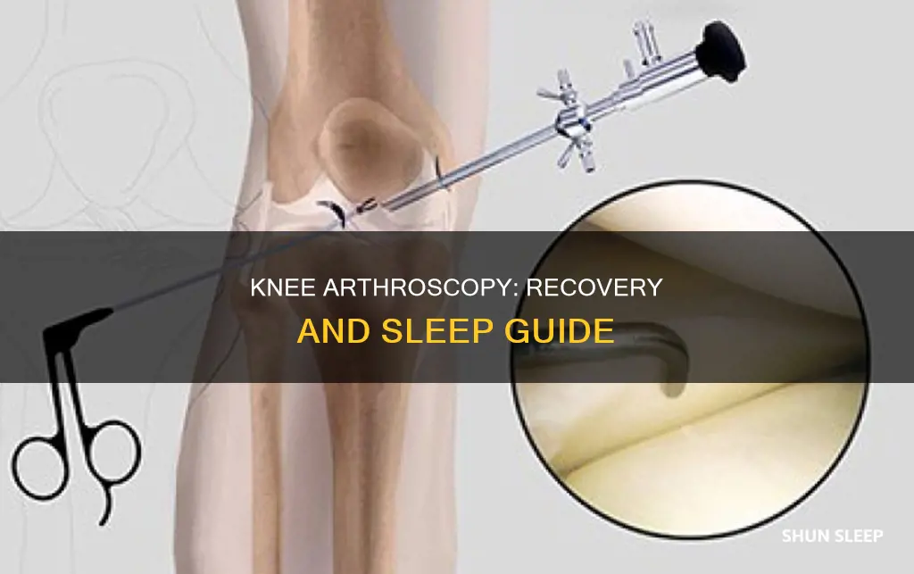 how many days sleeping after knee arthoscropy