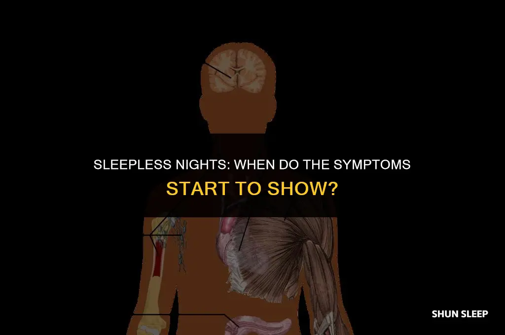 how many hours without sleep before symptoms