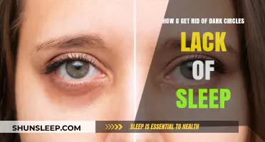 Banish Dark Circles: Quick Fixes for Sleep-Deprived Eyes