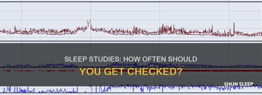 how often do i need a sleep study
