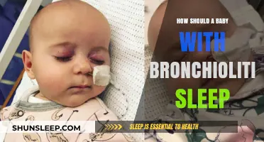 Safe Sleep Tips for Babies with Bronchiolitis: A Parent’s Guide