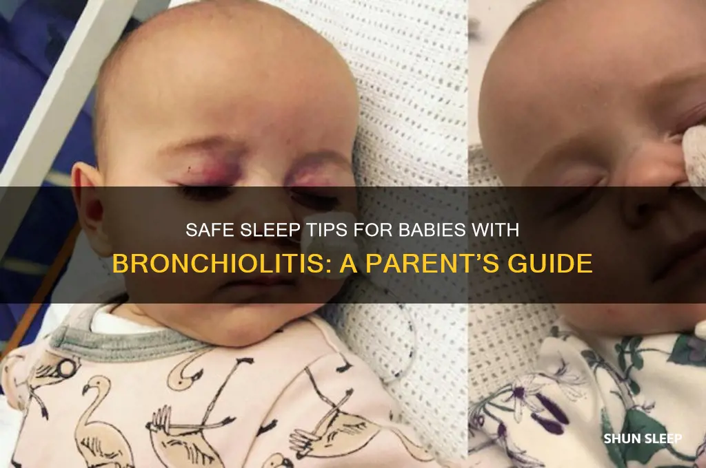 how should a baby with bronchiolitis sleep