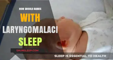 Safe Sleep Tips for Babies with Laryngomalacia: Expert Advice