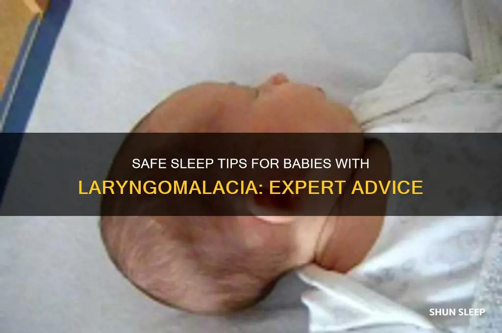 how should babies with laryngomalacia sleep