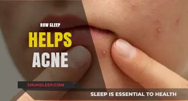 Sleep and Clear Skin: How Rest Fights Acne Naturally
