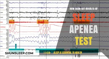 How Soon Can You Expect Sleep Apnea Test Results?