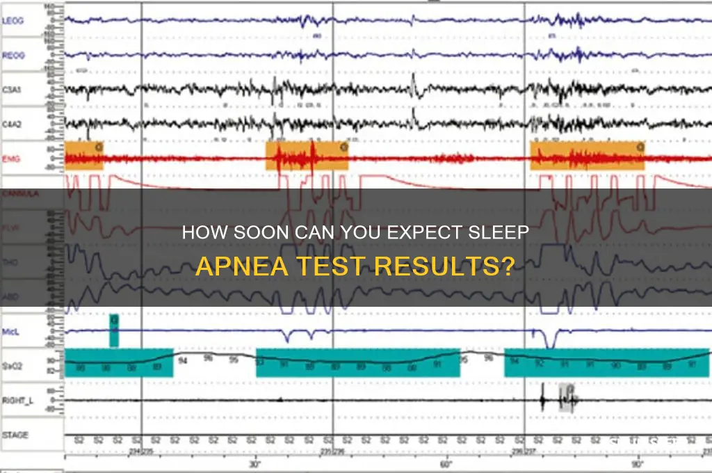 how soon get results of sleep apenea test