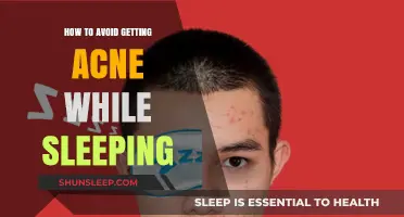 Sleep Clear: Nighttime Tips to Prevent Acne Breakouts