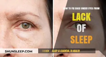 Erase Under-Eye Bags Caused by Sleep Deprivation