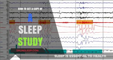 How to Obtain a Copy of Your Sleep Study Results