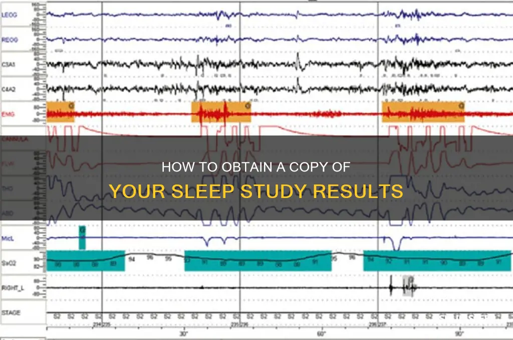 how to get a copy of a sleep study