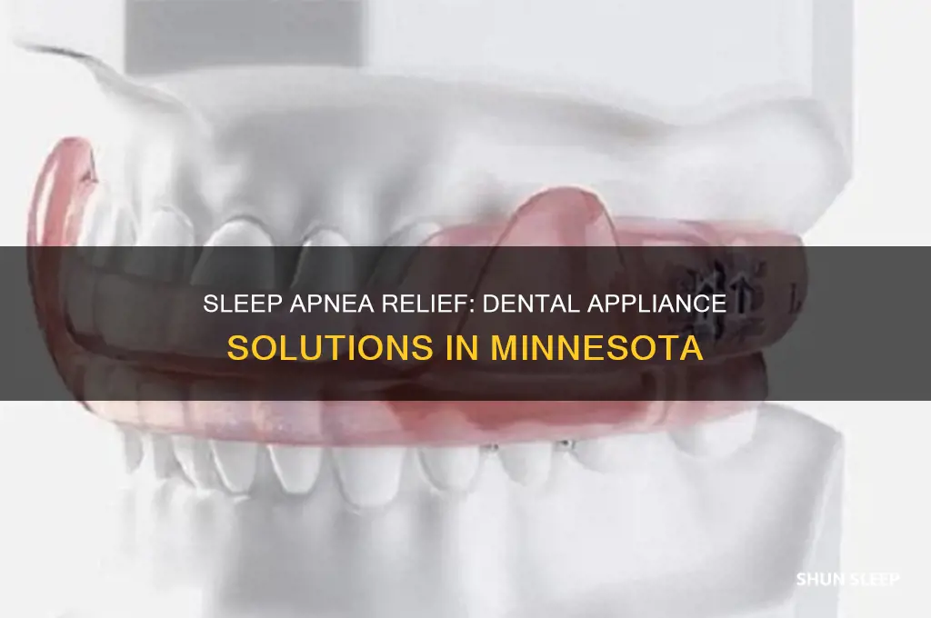 how to get a sleep apnea dental appliance mn