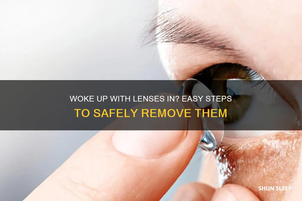how to get contact lenses out after sleeping