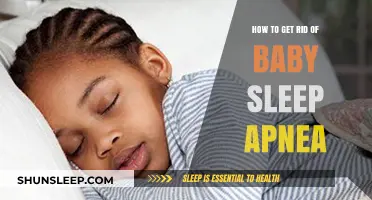 Effective Strategies to Treat and Prevent Baby Sleep Apnea Safely