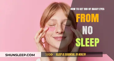 Banish Baggy Eyes: Quick Fixes for Sleep-Deprived Puffiness
