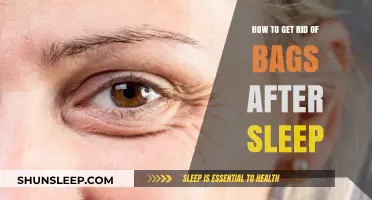 Wake Up Refreshed: Quick Fixes for Eliminating Under-Eye Bags After Sleep