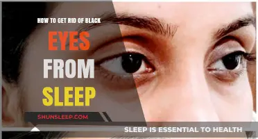 Banish Dark Circles: Effective Tips to Eliminate Sleep-Induced Black Eyes