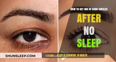 Quick Fixes for Dark Circles After a Sleepless Night