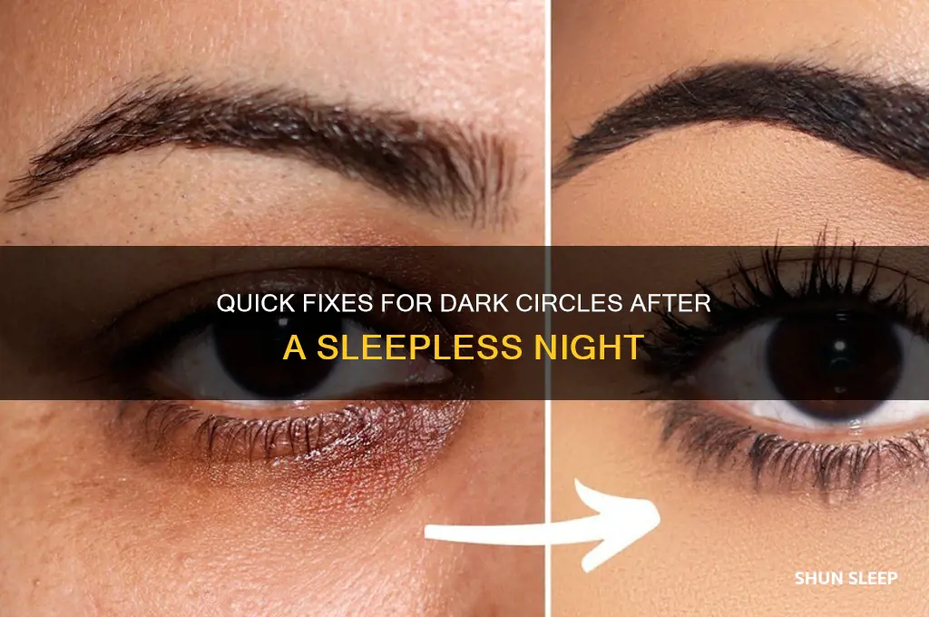 how to get rid of dark circles after no sleep