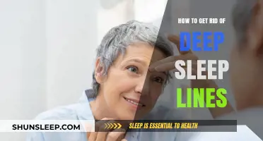 Erase Deep Sleep Lines: Effective Tips for Smoother, Younger-Looking Skin
