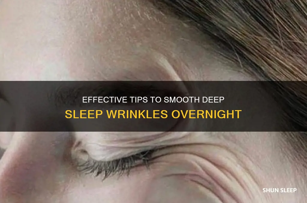 how to get rid of deep sleep wrinkles