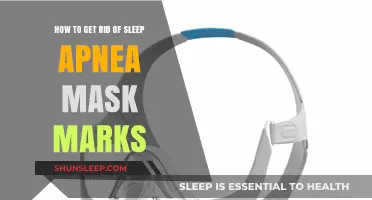 Effective Tips to Prevent and Remove CPAP Mask Marks Overnight