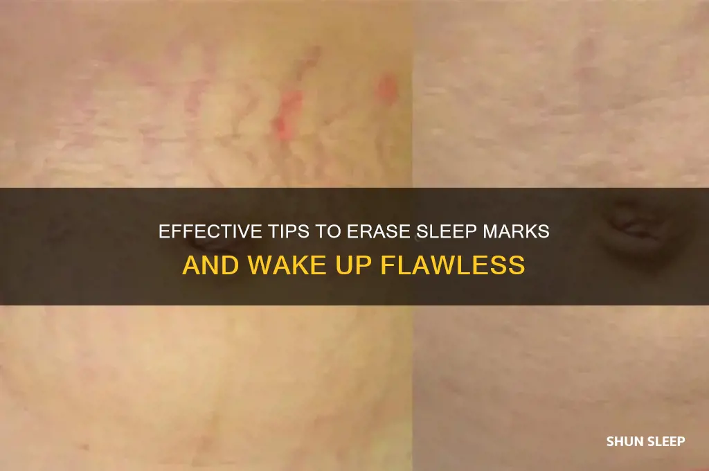 how to get rid of sleep marks