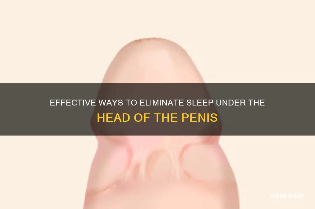 how to get rid of sleep under head of penis