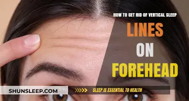 Erase Forehead Sleep Lines: Effective Tips for Smooth, Youthful Skin