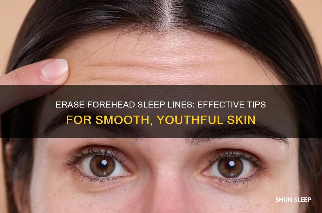 how to get rid of vertical sleep lines on forehead