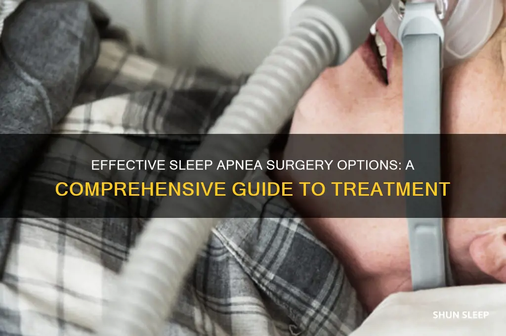 how to get sleep apnea surgery