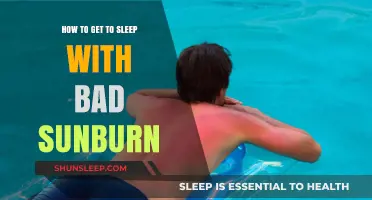Soothe Sunburn and Sleep: Tips for Comfortable Rest After Burns