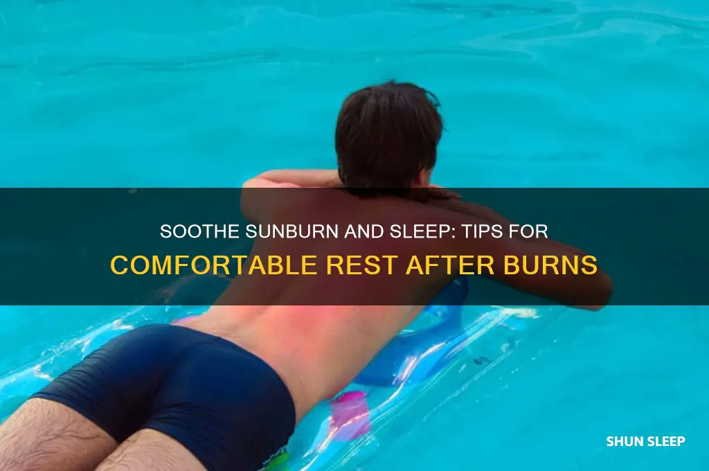 how to get to sleep with bad sunburn