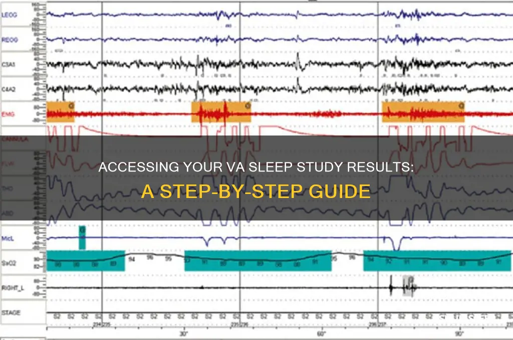 how to get va sleep study results