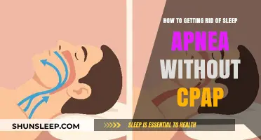 Effective Ways to Treat Sleep Apnea Without CPAP Therapy