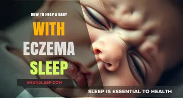 Soothing Eczema Flare-Ups: Gentle Tips for Baby's Peaceful Sleep
