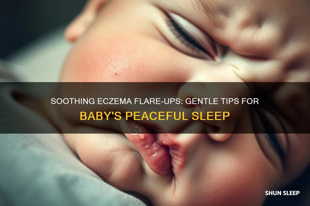 how to help a baby with eczema sleep