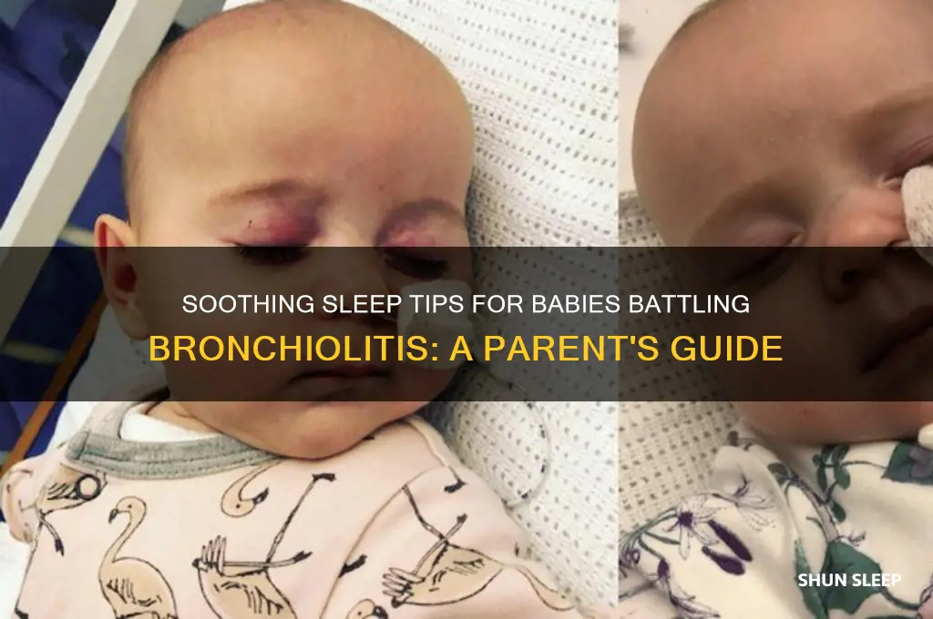 how to help baby sleep with bronchiolitis