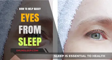 Revive Tired Eyes: Quick Fixes for Baggy Eyes After Sleep