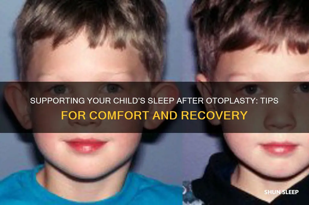 how to help child sleep after otoplasty